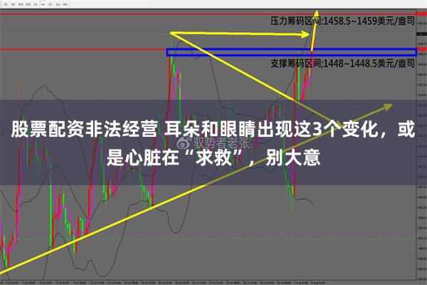 股票配资非法经营 耳朵和眼睛出现这3个变化，或是心脏在“求救”，别大意